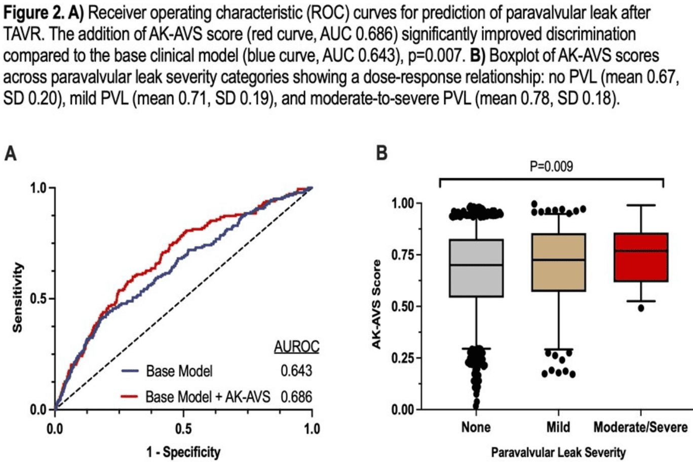 preoperative-AI-ECG-analysis.png