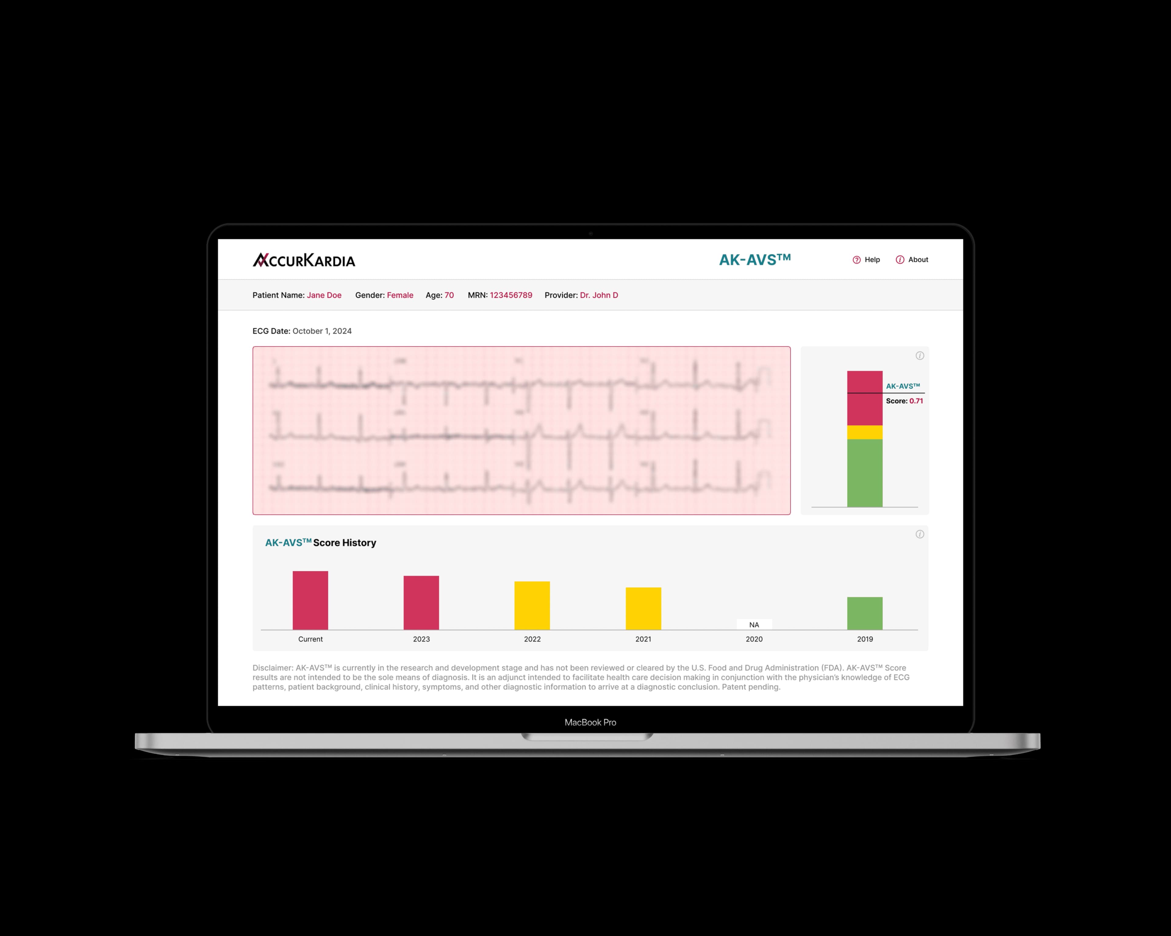mobile AK mock screen